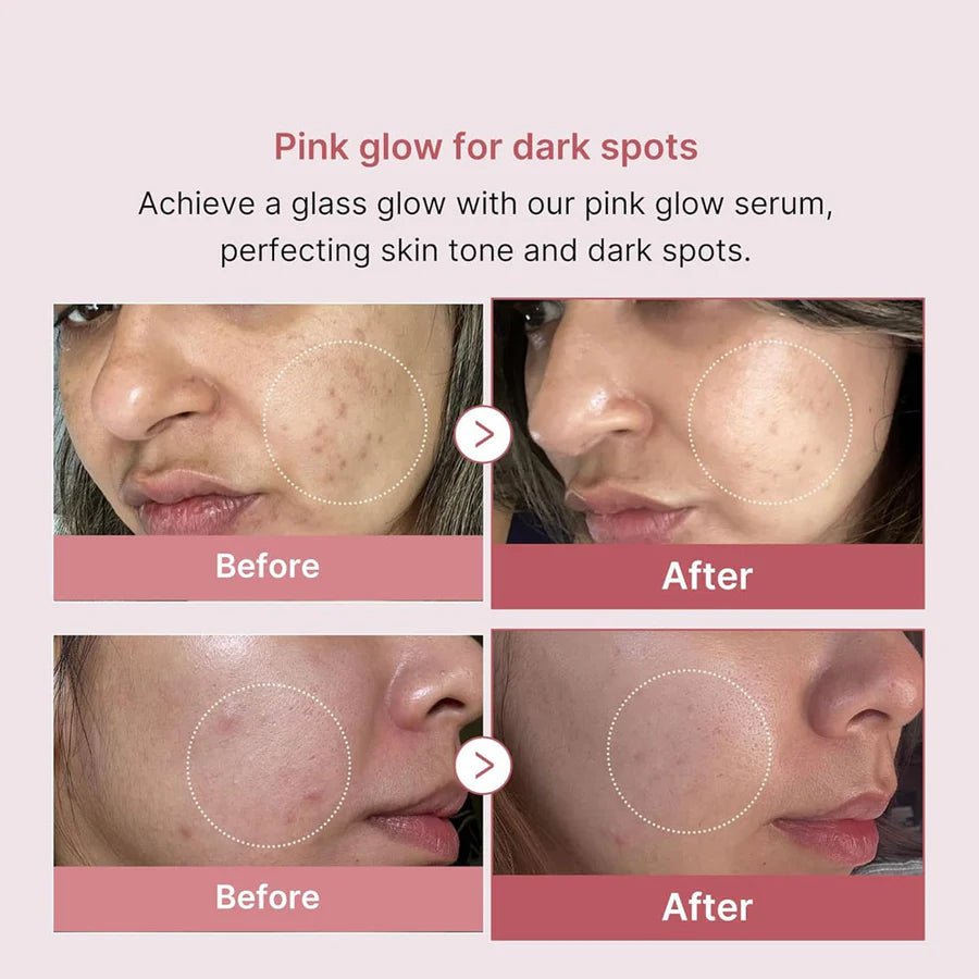Medicube PDRN Pink Peptide serum - Beauty Icon -