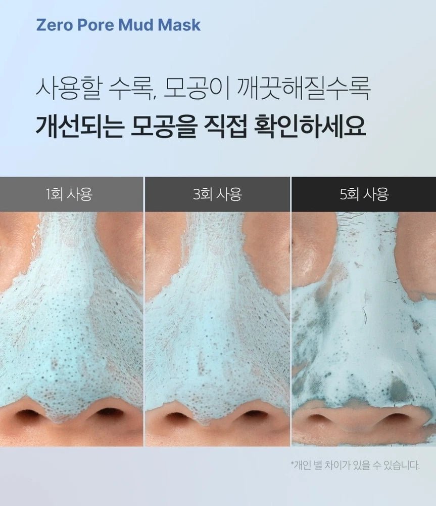 Medicube Zero Pore Blackhead Mud Mask - Beauty Icon -
