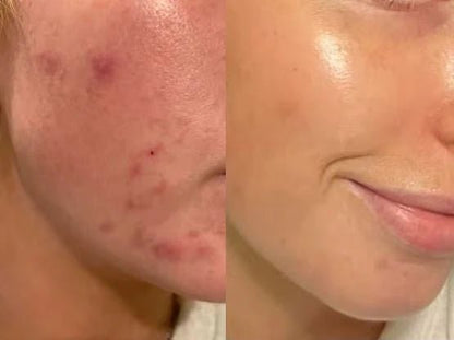 Paula's Choice Skin Perfecting 2% BHA Liquid Exfoliant - Beauty Icon - 